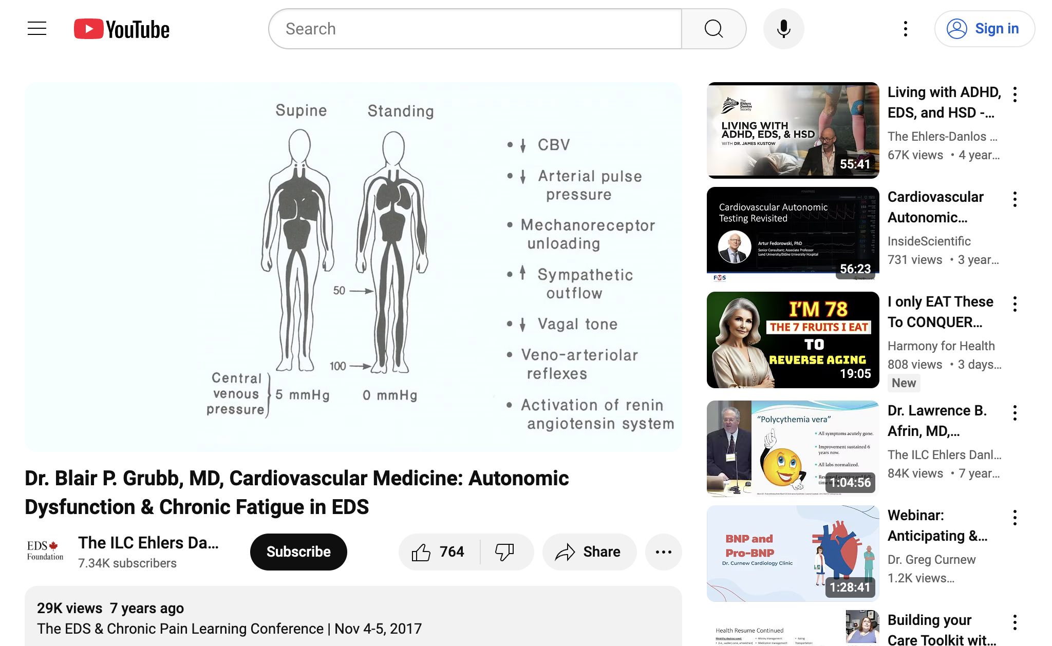 Dr. Blair P. Grubb, MD, Cardiovascular Medicine: Autonomic Dysfunction & Chronic Fatigue in EDS