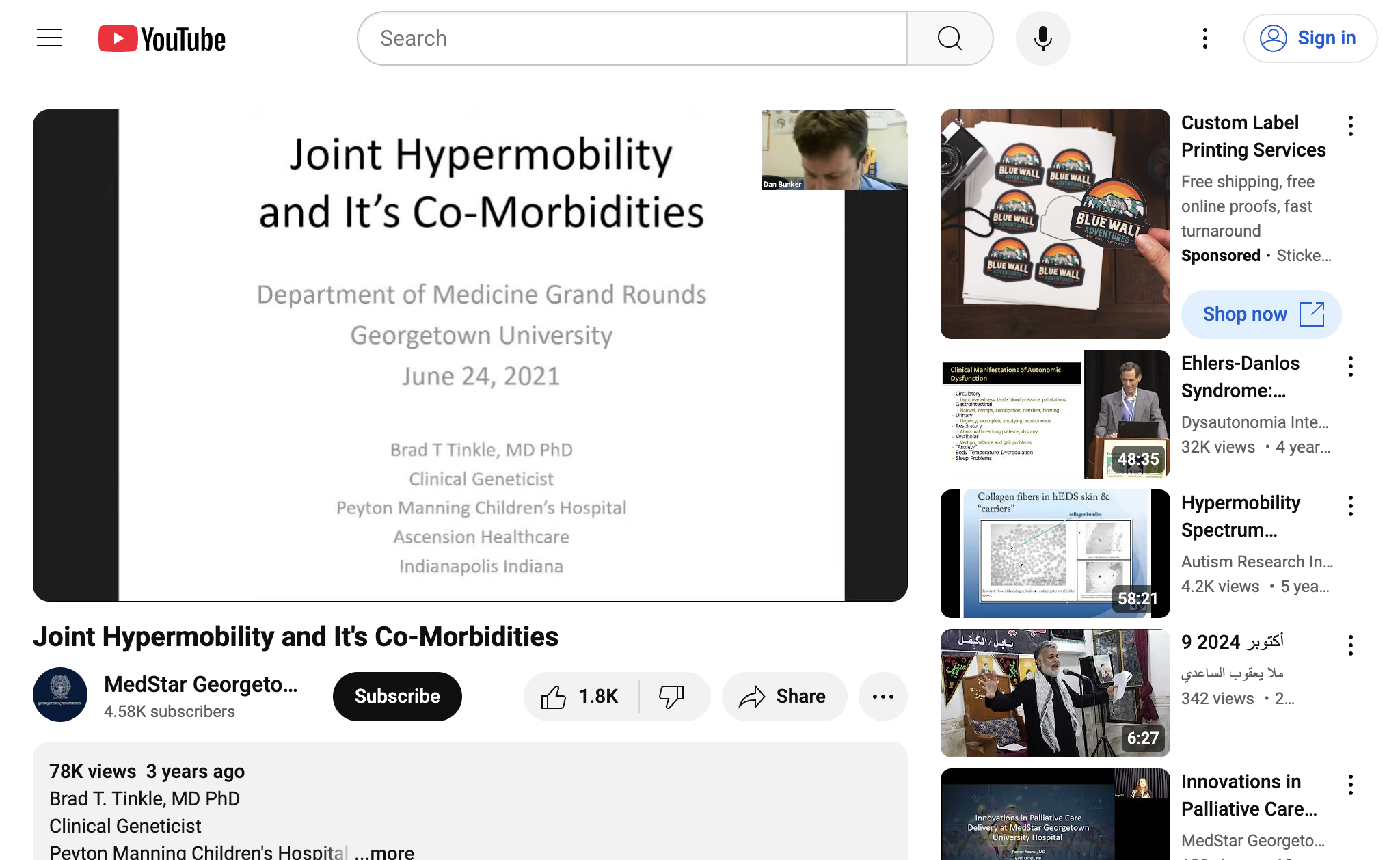 Joint Hypermobility and It's Co-Morbidities