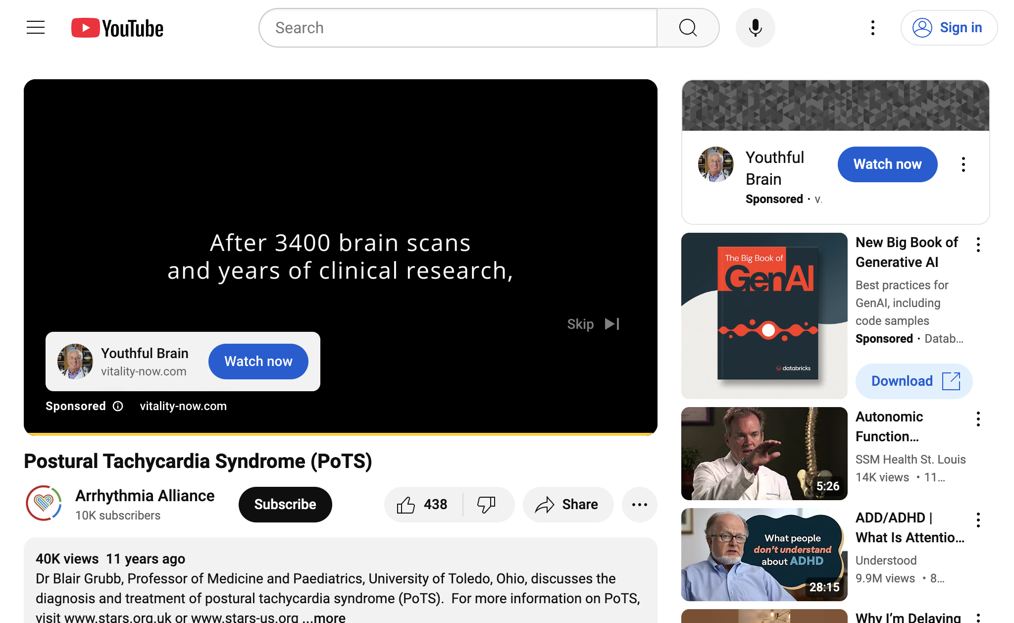 Postural Tachycardia Syndrome (PoTS)