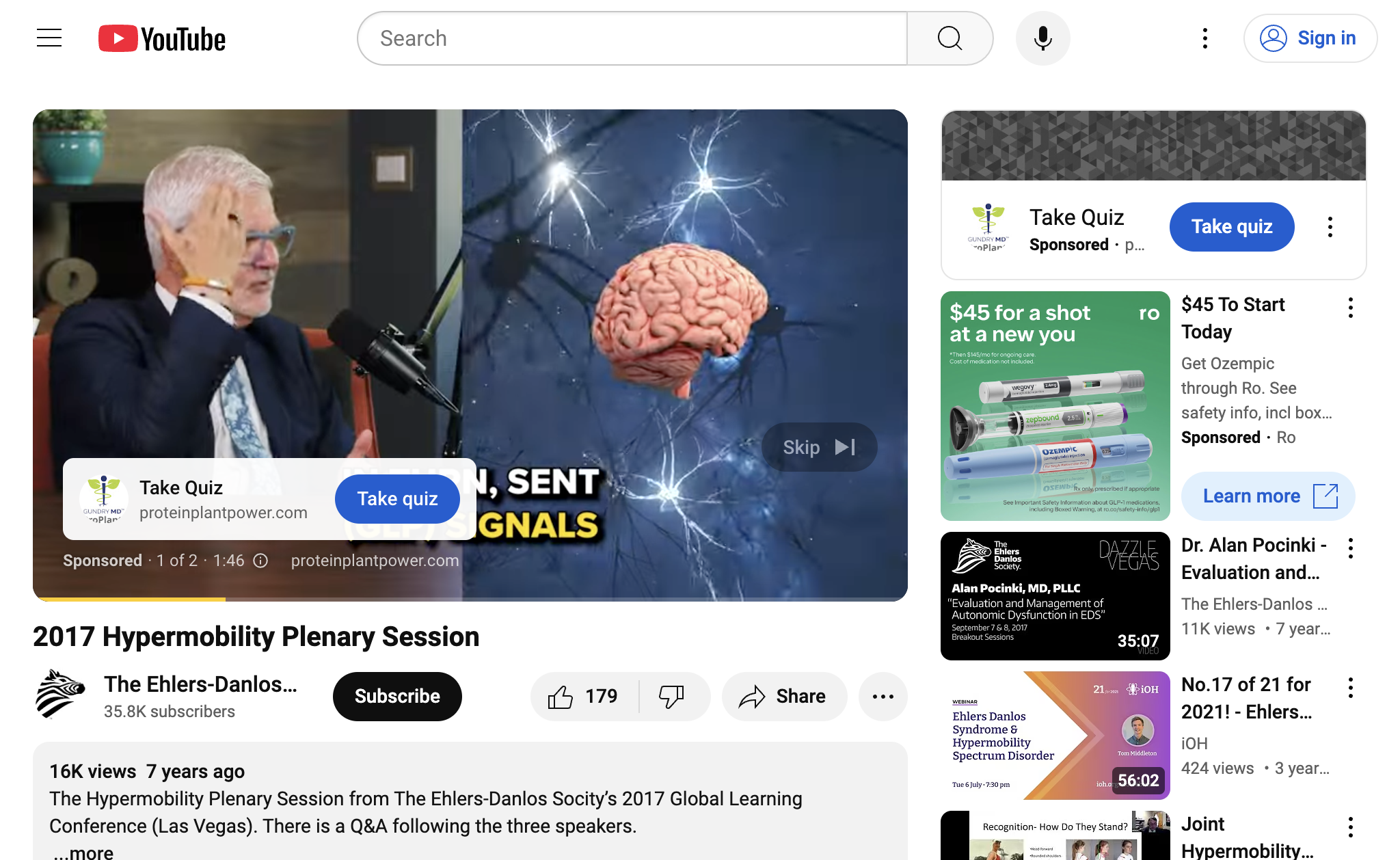 2017 Hypermobility Plenary Session