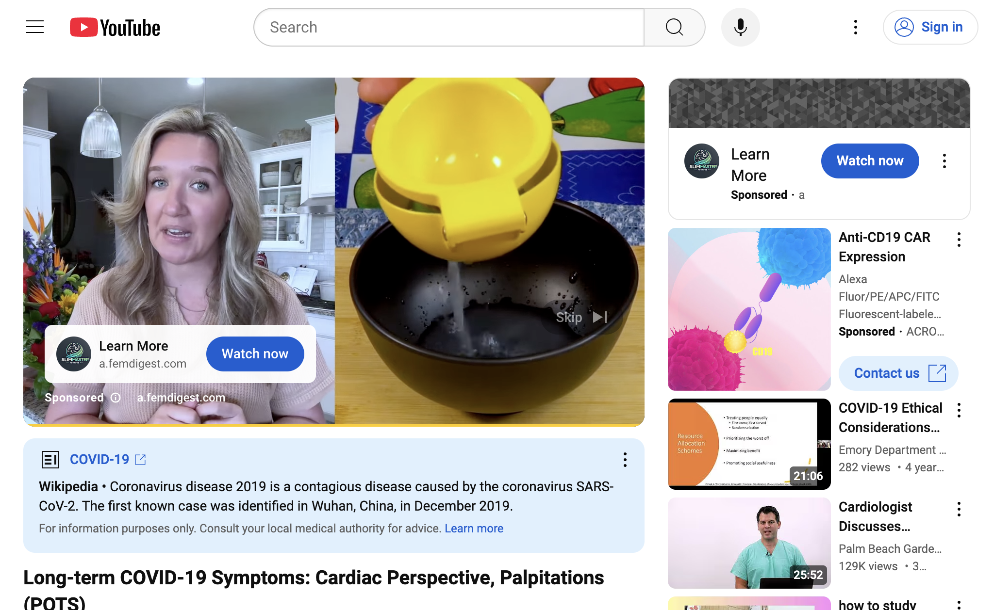 Long-term COVID-19 Symptoms: Cardiac Perspective, Palpitations (POTS)
